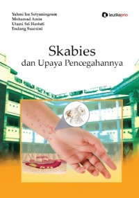 Skabies dan Upaya Pencegahannya